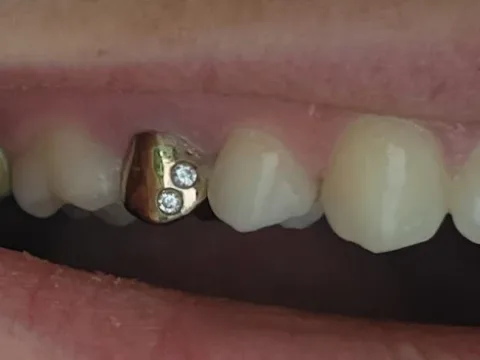 Marks Jewelers